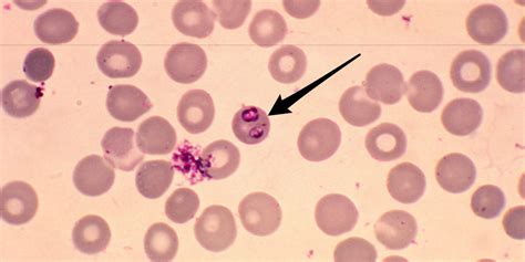  Babesia! Tiny Blood Parasites With a Big Impact on Animal Health