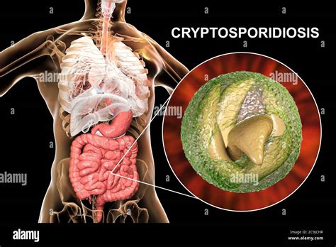  Cryptosporidium!  Tiny Parasites that Cause Big Problems for Humans and Animals