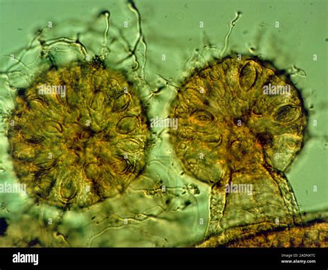 Which Colonial Hydroid Is Known For Its Tentacles That Can Detect Even The Tiniest Vibration In Water?